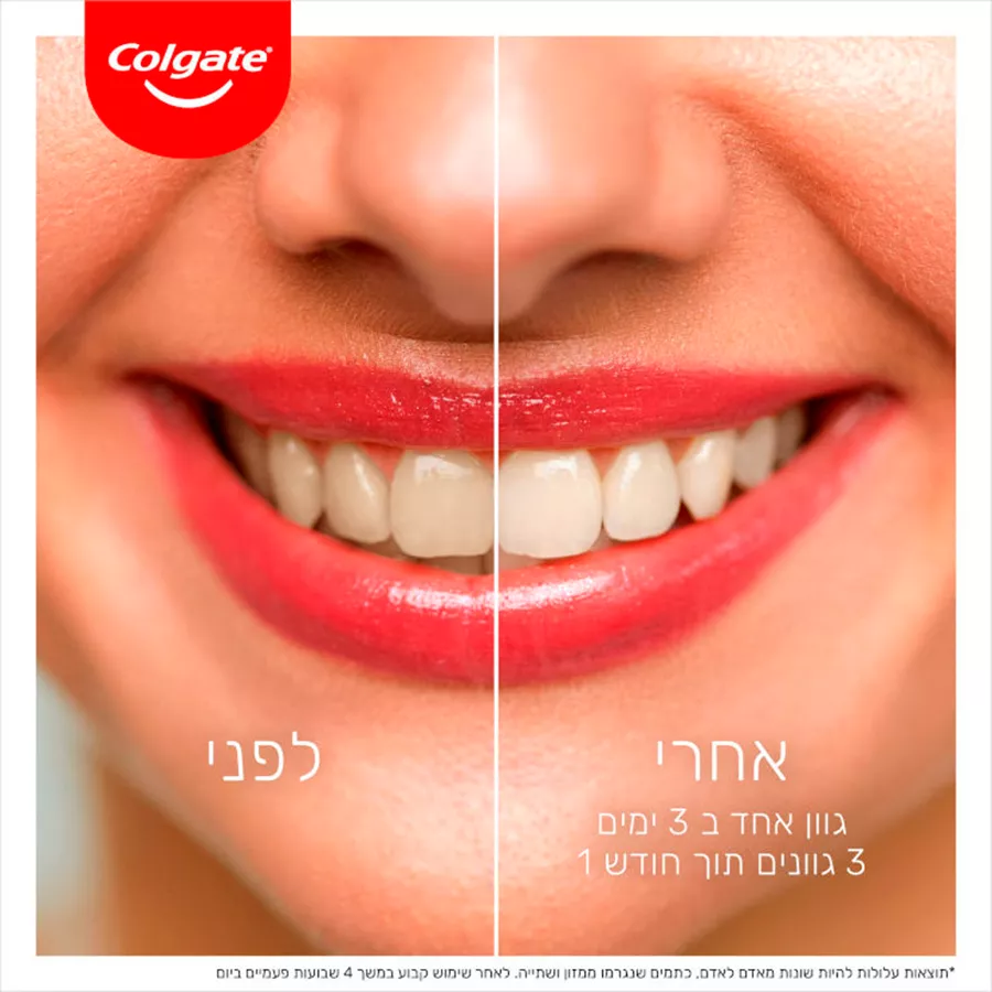 קולגייט משחת שיניים אופטיק ווייט חמצן Colgate